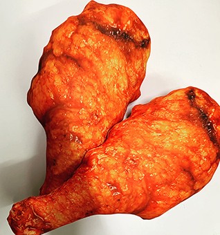 หมอนน่องไก่